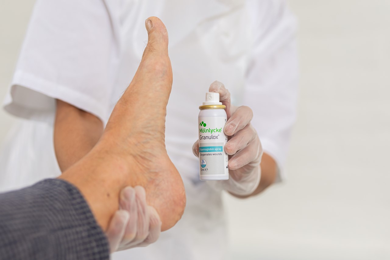 Granulox® Topical oxygen supply for accelerated wound healing